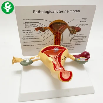 Патологична модел на матката и яйчниците патологична модел на матката, Вагинална обучение модел на яйчниците
